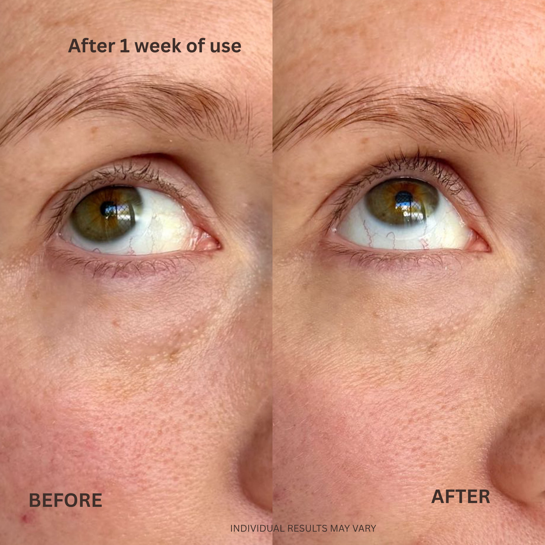 Brighten & Hydrate Botanical Eye Gel